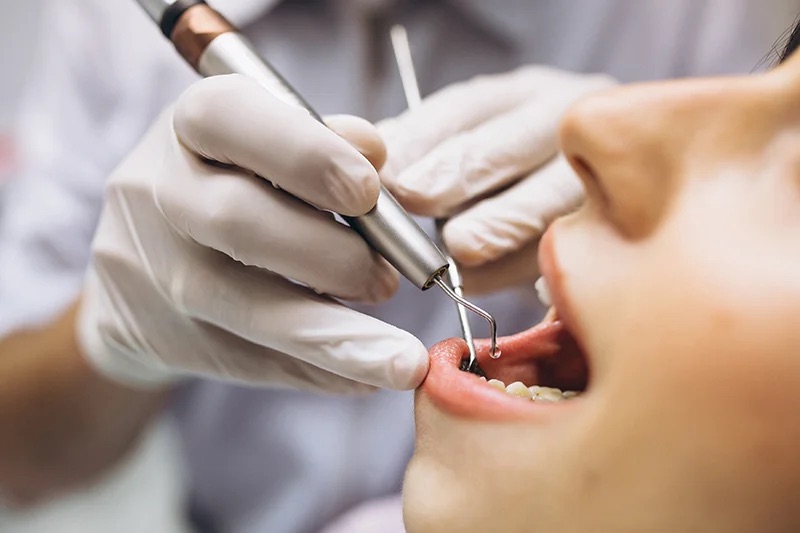 Dental implant financing options